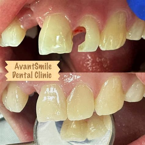 avantsmile dental clinic|AvantSmile Dental Clinic.